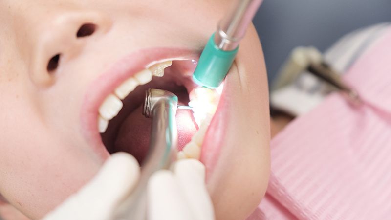 歯科治療の基礎知識