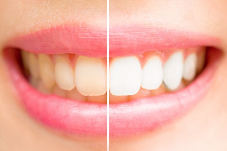 Comprehensive Guide to Choosing and Using a Toothbrush